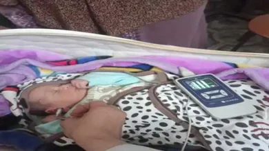 فحص 4 ملايين و851 ألف طفل ضمن المبادرة الرئاسية للكشف المبكر وعلاج ضعف وفقدان السمع